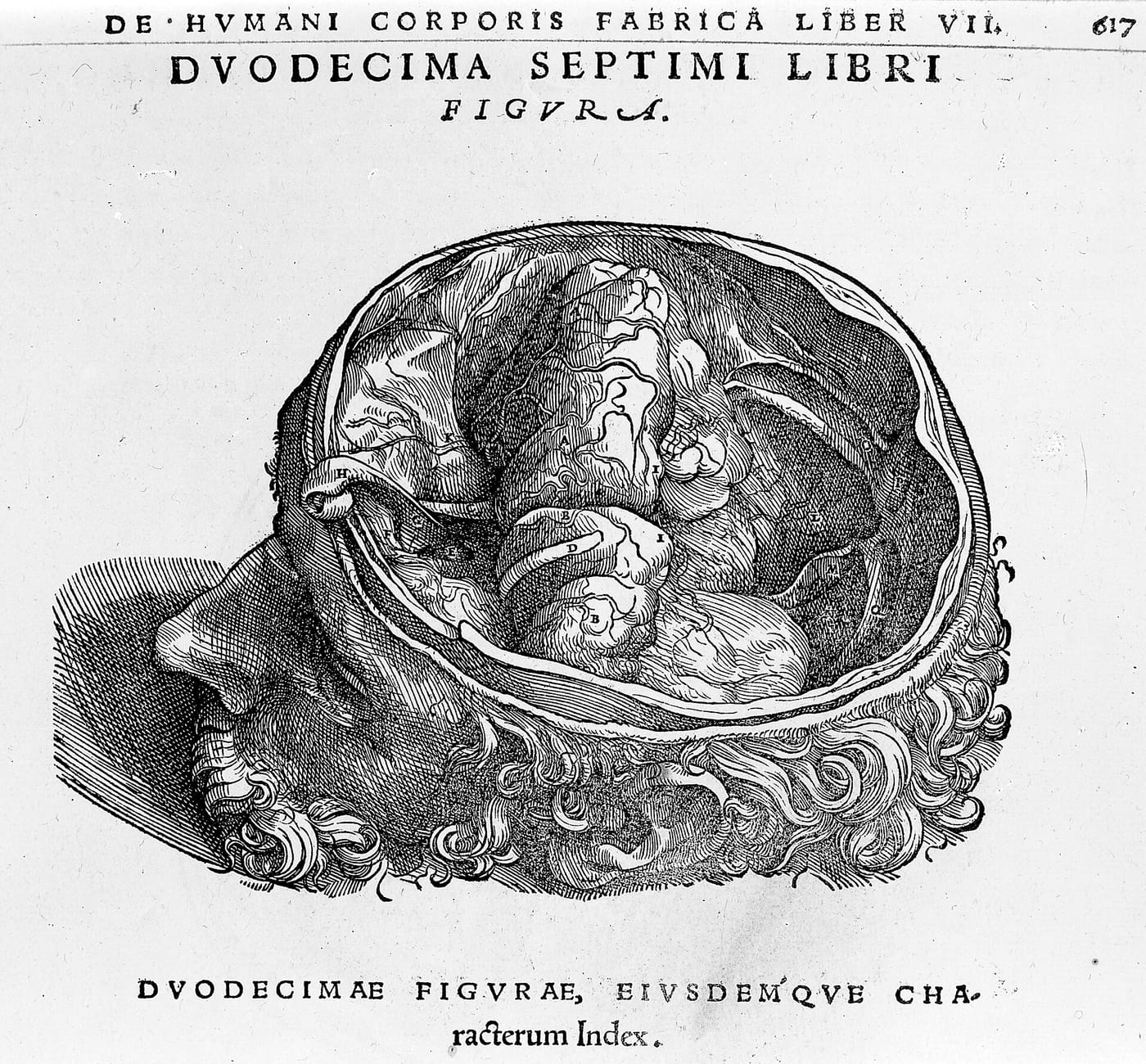 Vesalius' drawing of the brain