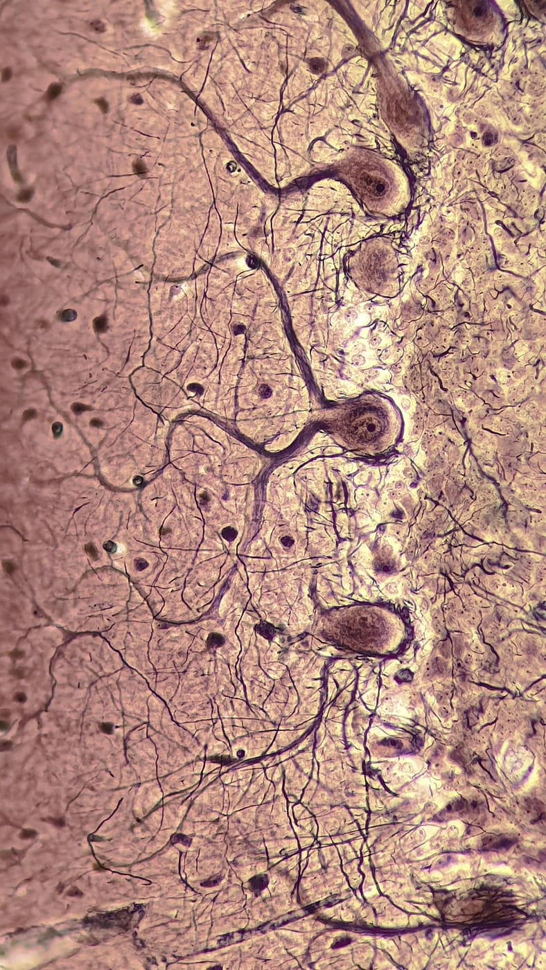 neurons
