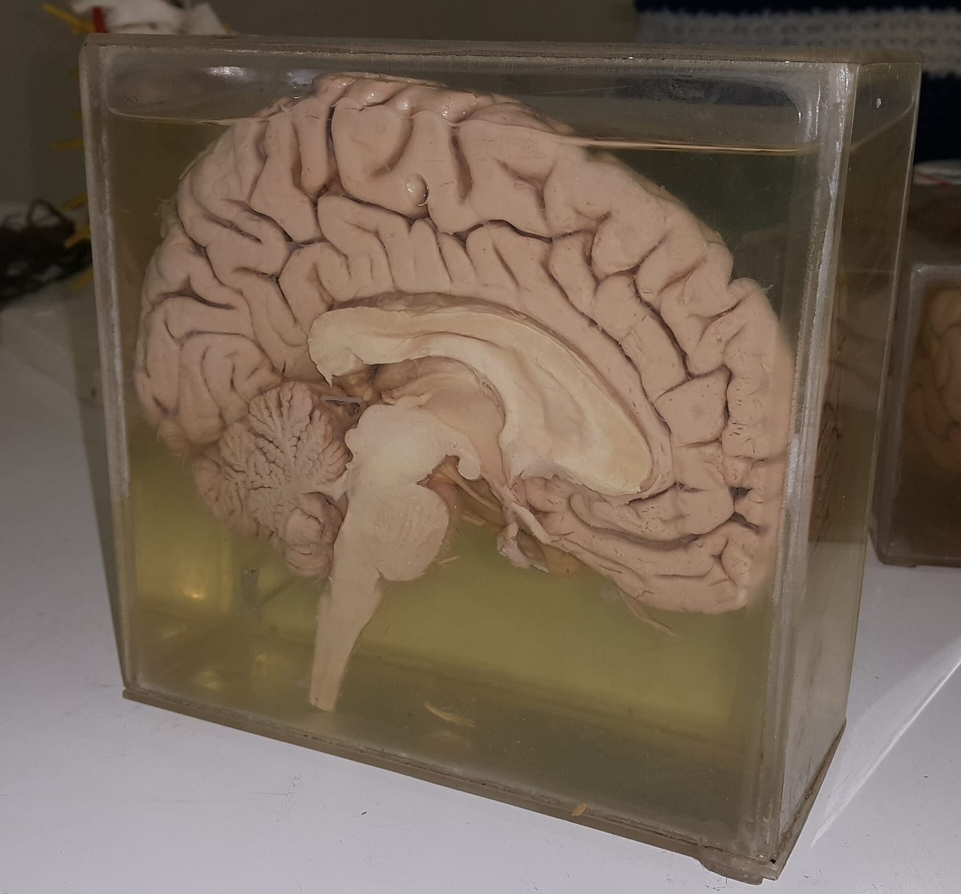 human brain, the brain