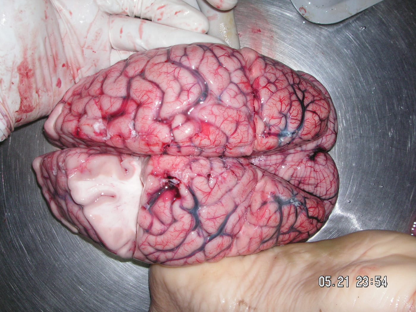 human brain, the brain