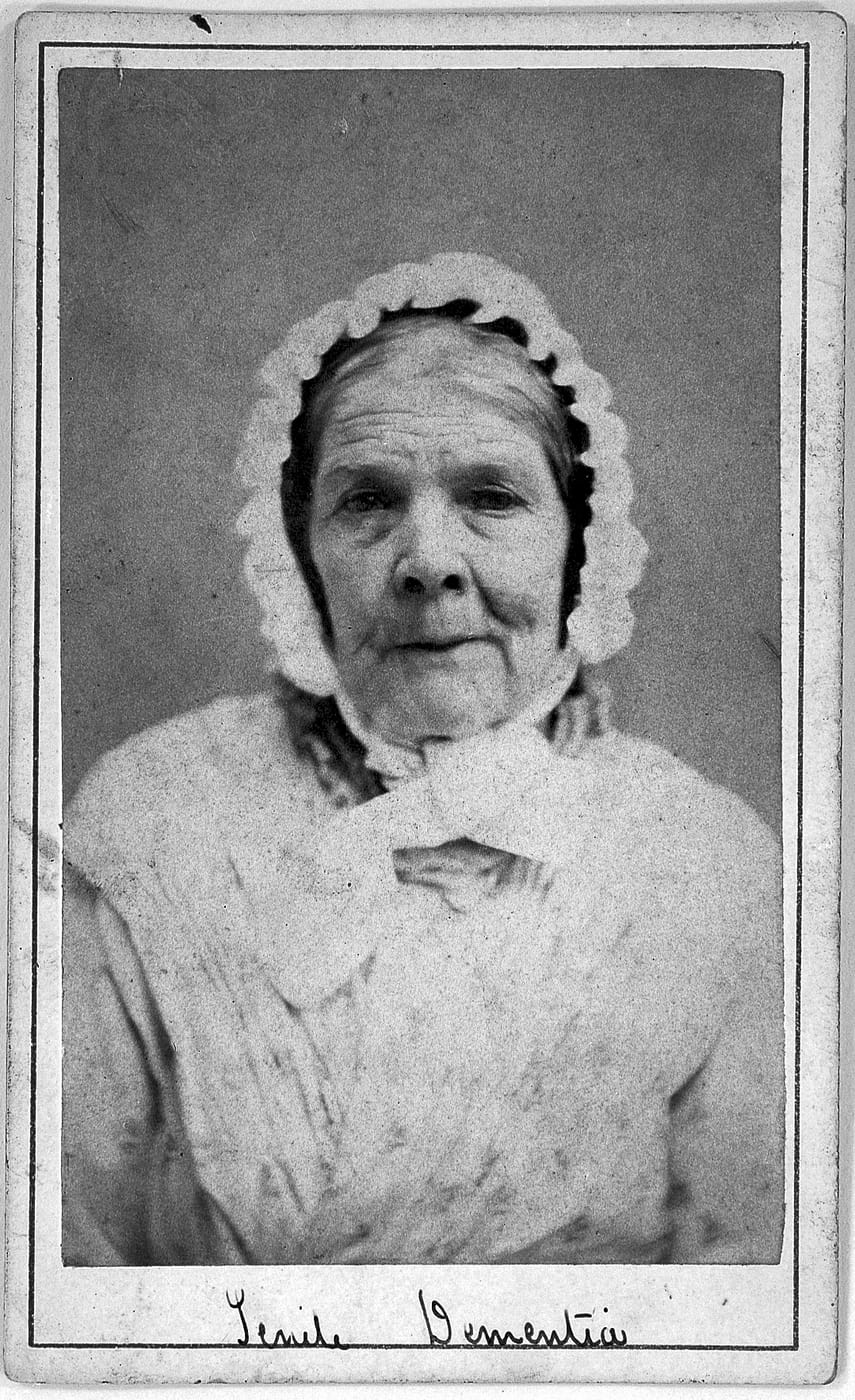 Female patient with senile dementia, a person with advanced dementia