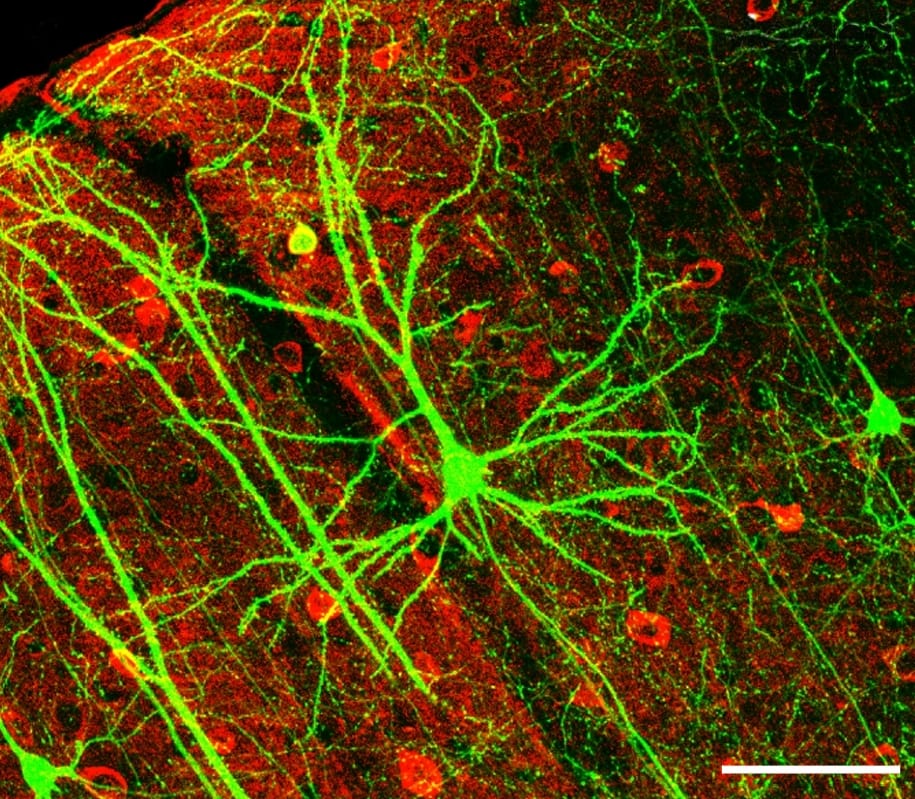 A single neuron under fluorescence