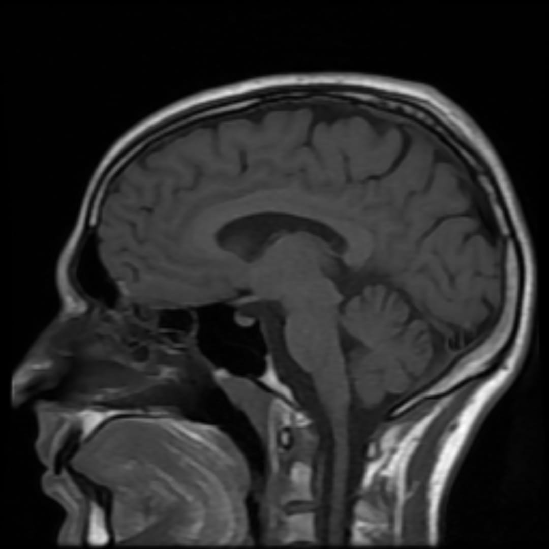 A sagittal MRI of the human brain