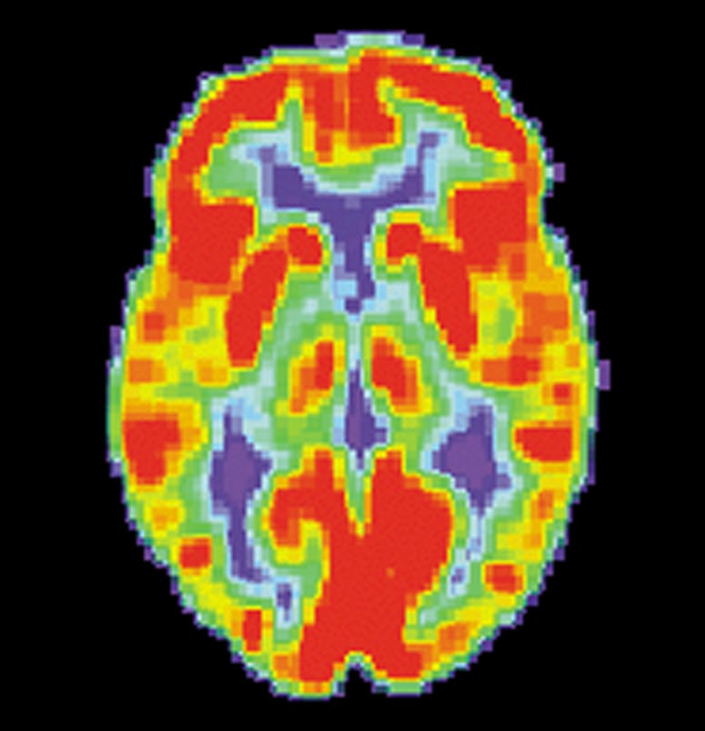 brain activity, more coordinated, widely shared brain activity