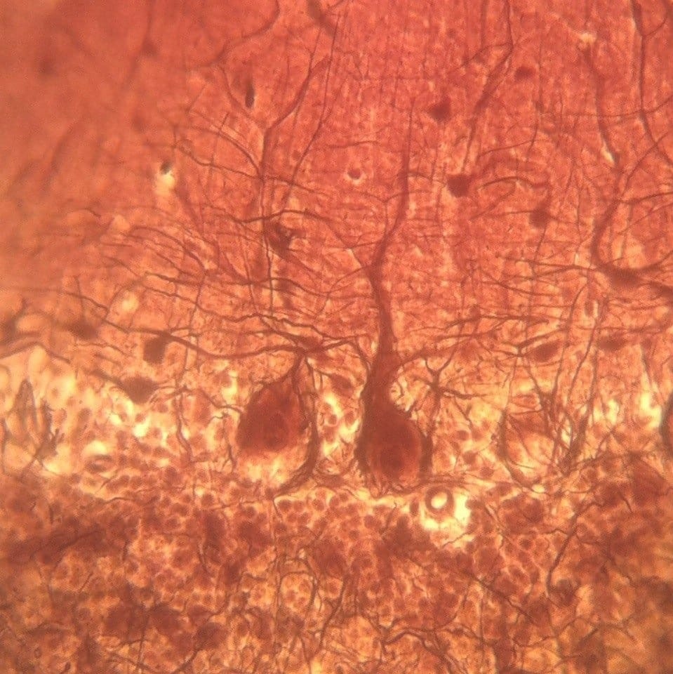 Purkinje cells in the cerebellar cortex